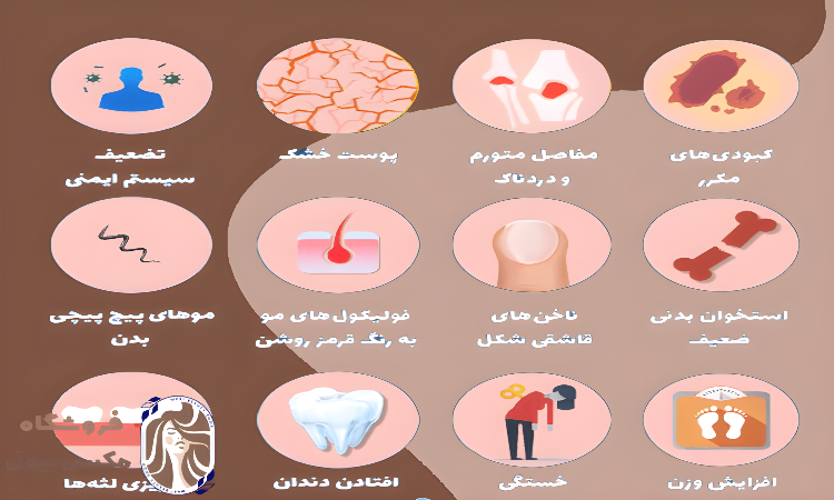 کمبود ویتامین سی