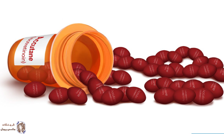 راکوتان چیست؟